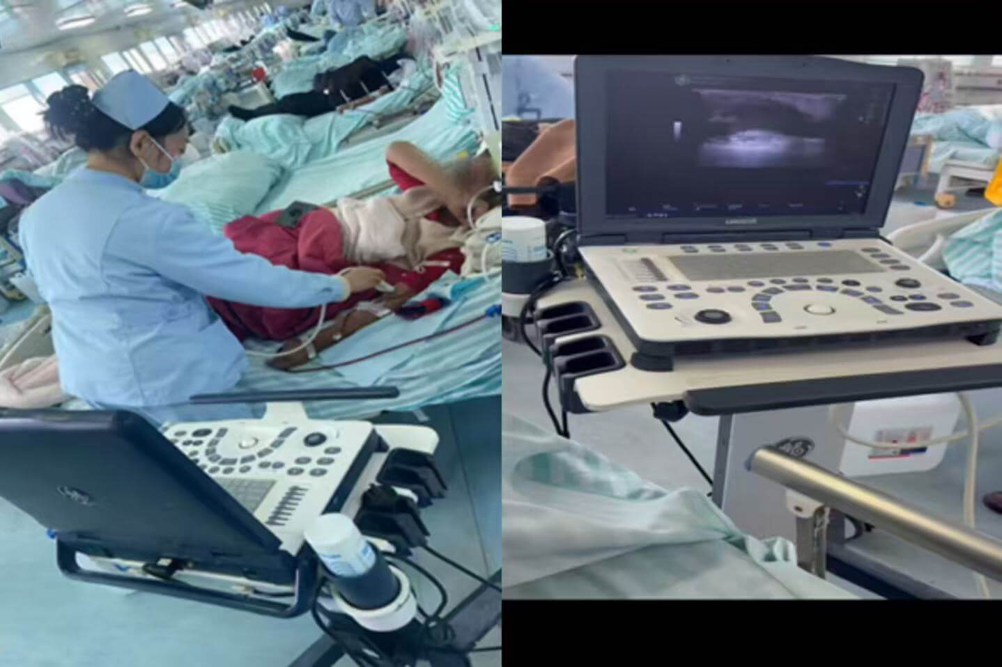 9df7babedd6434d0095bed5a8fadd7af