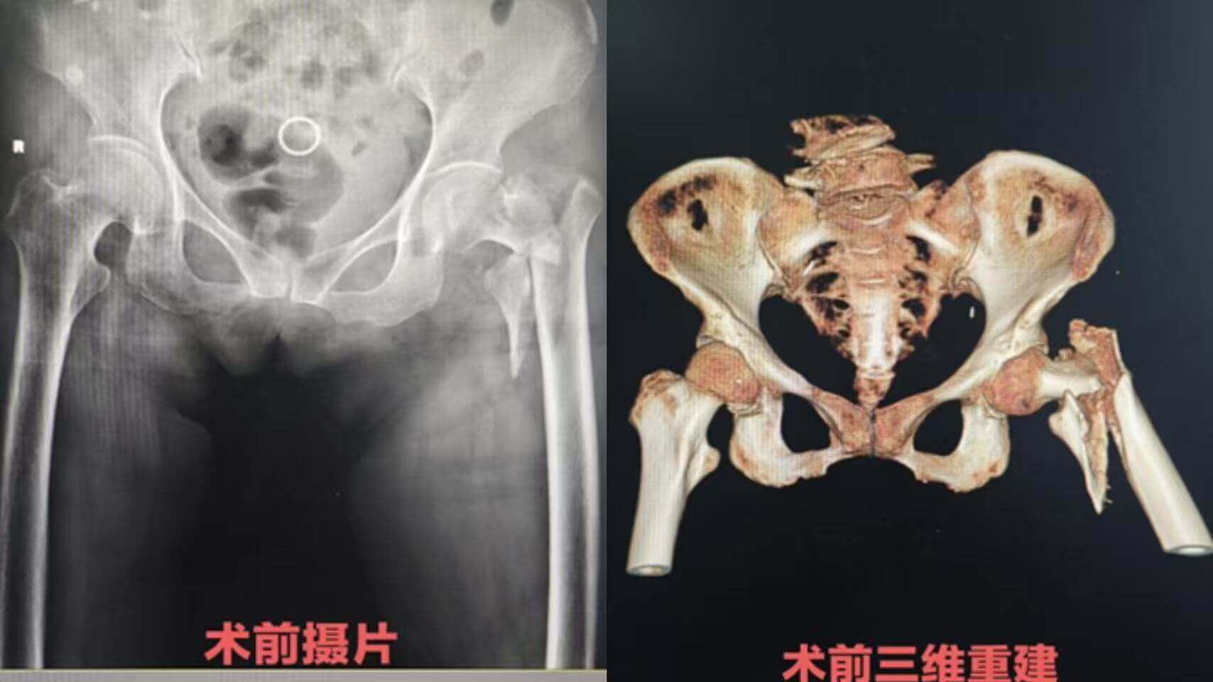 358a8a76385a27eb83b1aee48a1c4b4b