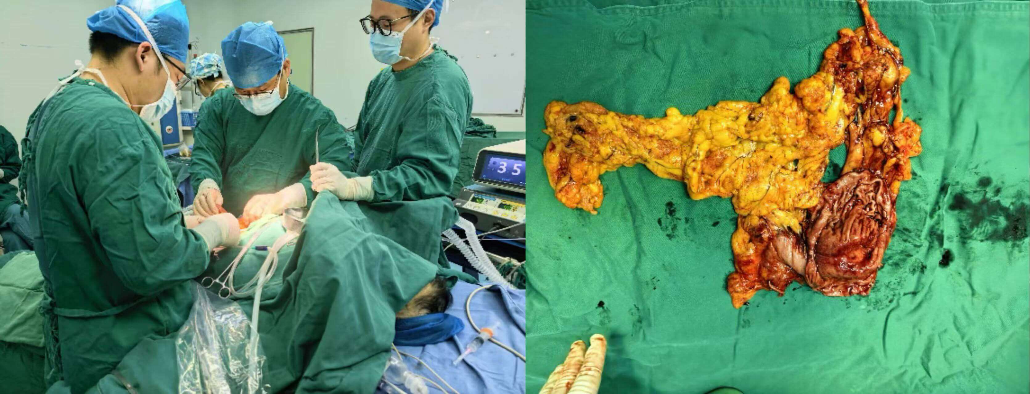 62ffe2e1945b5677752f5b0f8101f1d4