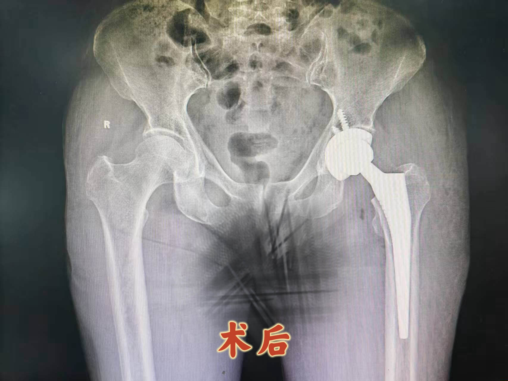 4b7c15b2d126ea7b7812e3d6397475b0