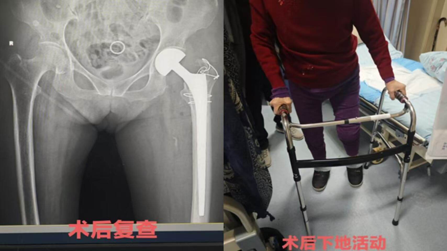 f95b2d38c7af3888024d166d3ffc8cf6