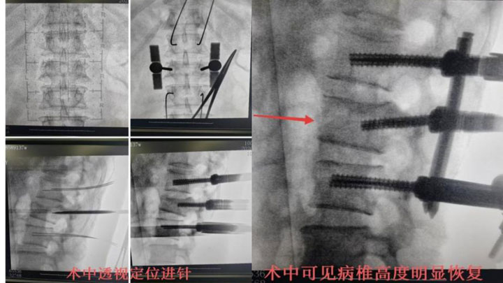 23f115cd3a3c5714d216dd2fa7156a04