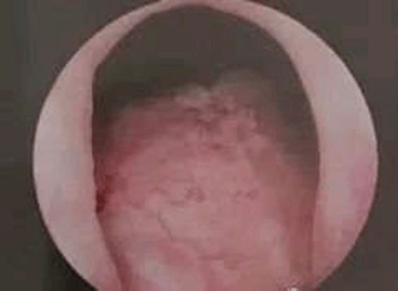 419827c04e781f8dfdb78b4c7e73164d