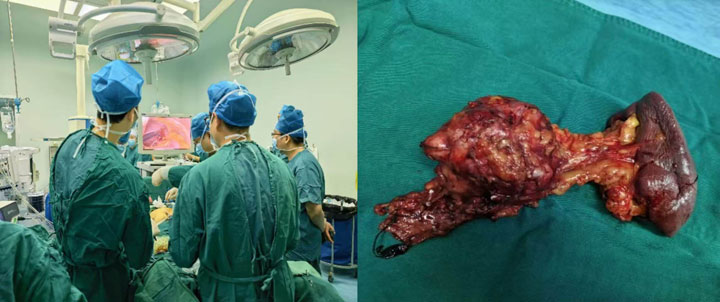 437e526170ba8933d4037bbdbcd83072